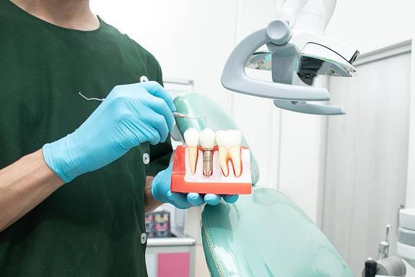 种植牙价格表二十万（种植牙集采推进）(4)