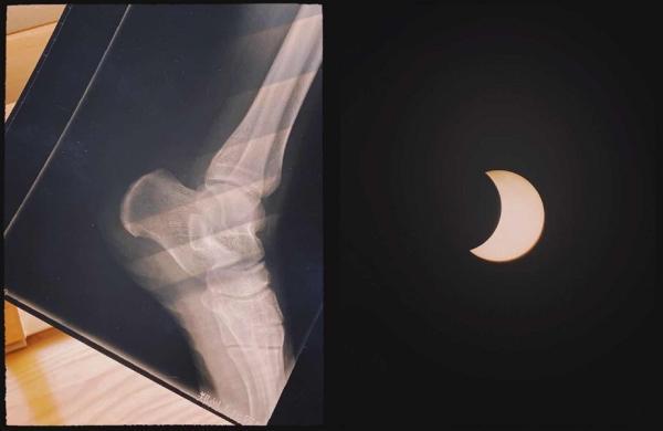 日环食即将到来准备好了吗（日环食还有这些）(2)