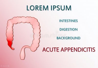​阑尾炎症状表现有哪些（阑尾炎会有这些症状表现）