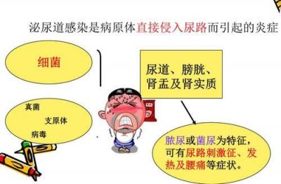 ​泌尿系统感染用什么药效果好(泌尿系统感染怎么办)